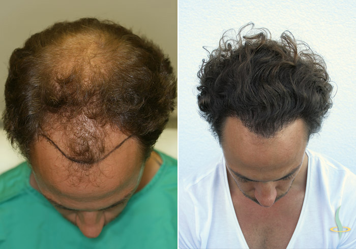 Links: vorher / rechts: nach dritter Operation